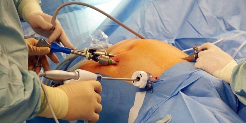 When Is Gallbladder Surgery Necessary and Can It Wait? | Dr. Pinak Dasgupta