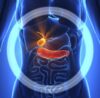 9 Effective Ways to Prevent the Risk of GallStone Problem
