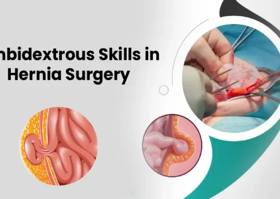 Ambidextrous skills in hernia surgery by Dr Pinak Dasgupta, robotic hernia surgeon in Chennai