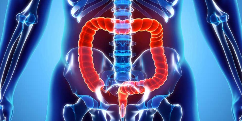 Rectal Prolapse Treatment in Chennai by Dr. Pinak Dasgupta, expert robotic and laparoscopic colorectal surgeon